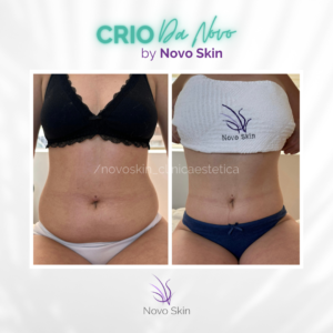 Crio Da Novo® Zona pequeña